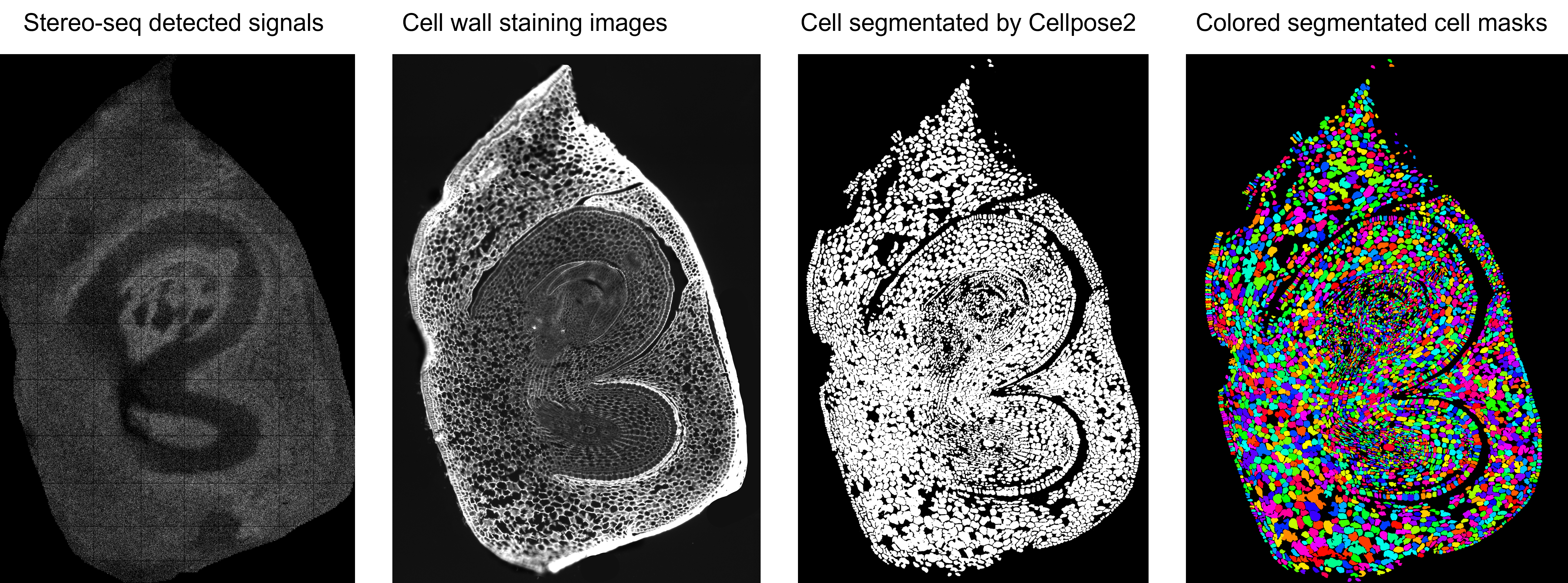 Cellsegmentation